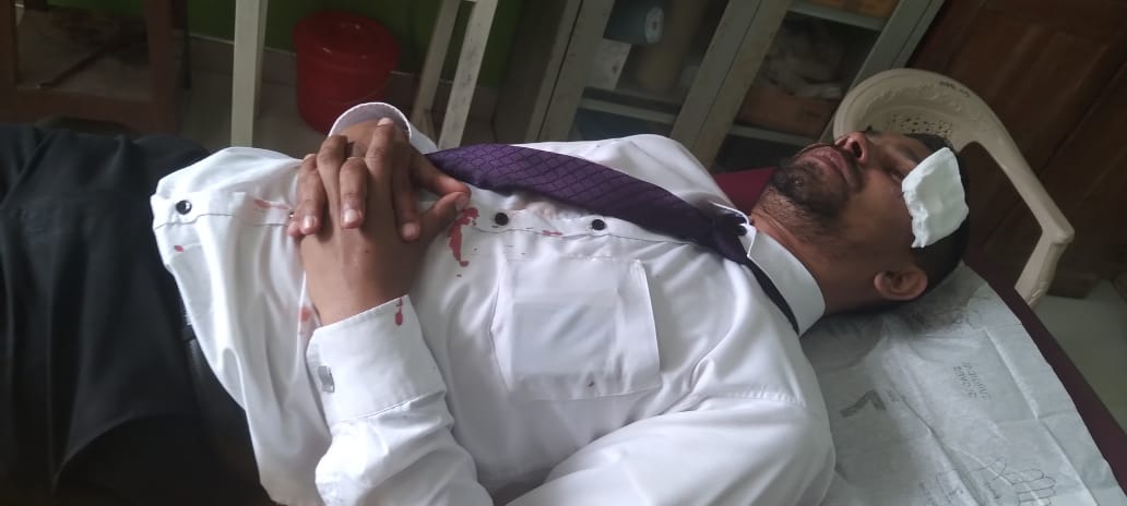 මස්කෙළිය උප සභාපතිවරයා සහ තවත් මන්ත්රිවරයෙකු අතර ගැටුමක් – උප සභාපති පහරකා රෝහලේ මස්කෙළිය උප සභාපතිවරයා සහ තවත් මන්ත්රිවරයෙකු අතර ගැටුමක් – උප සභාපති පහරකා රෝහලේ