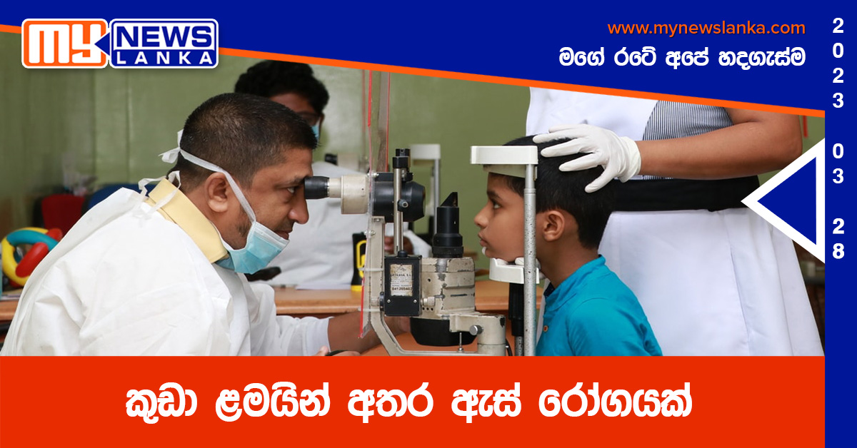 කුඩා ළමයින් අතර ඇස් රෝගයක් කුඩා ළමයින් අතර ඇස් රෝගයක්