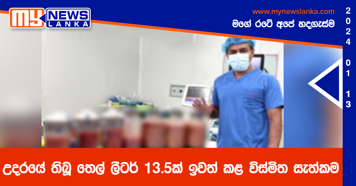 උදරයේ තිබූ තෙල් ලීටර් 13.5ක් ඉවත් කළ විස්මිත සැත්කම
