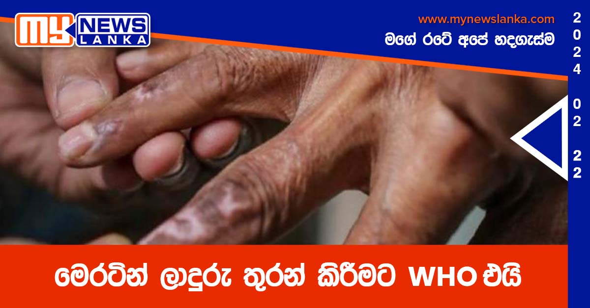 මෙරටින් ලාදුරු තුරන් කිරීමට WHO එයි මෙරටින් ලාදුරු තුරන් කිරීමට WHO එයි