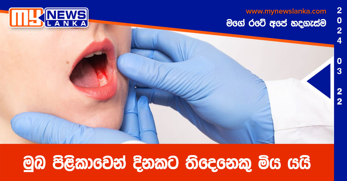 මුඛ පිළිකාවෙන් දිනකට තිදෙනෙකු මිය යයි