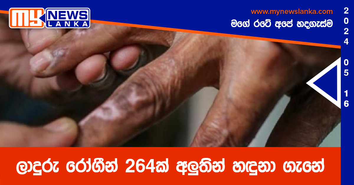 ලාදුරු රෝගීන් 264ක් අලුතින් හඳුනා ගැනේ ලාදුරු රෝගීන් 264ක් අලුතින් හඳුනා ගැනේ