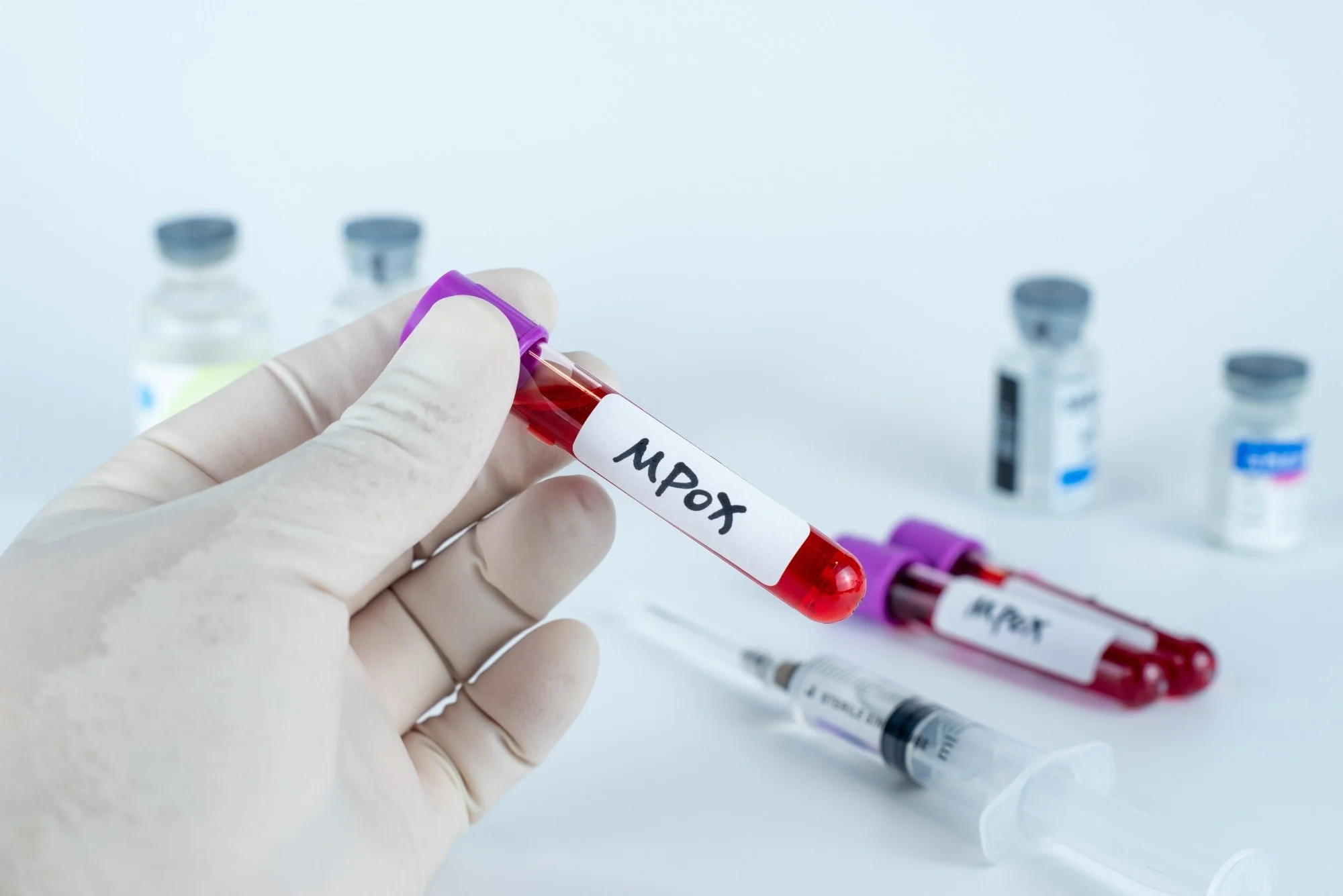 Mpox ආවොත් අපි ලෑස්තිද ?