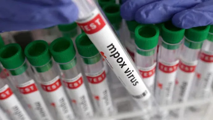 Mpox ආසාදිත පුද්ගලයෙක් ඉන්දියාවෙන් හමුවෙයි Mpox ආසාදිත පුද්ගලයෙක් ඉන්දියාවෙන් හමුවෙයි