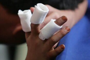 ළමුන් හදිසි අනතුරුවලට ගොදුරු වීම ඉහළට